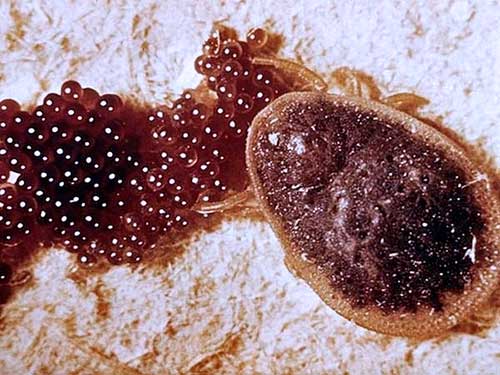 Самка клеща откладывает яйца